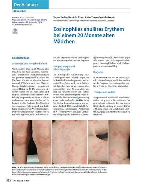 Pdf Eosinophilic Annular Erythema In A 20 Month Old Girl
