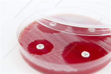 Antibiotic Sensitivity Testing Stock Image C0291346 Science