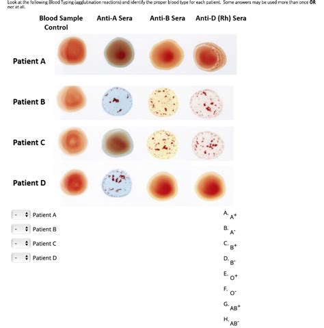 ️blood Type Questions Worksheet Free Download