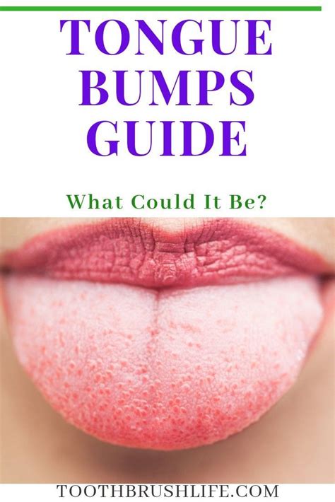10) excessive smoking excessive smoking is the other common reason for the formation of white bumps on the tongue. Tongue Bumps Guide - Here's What You Need To Know ...