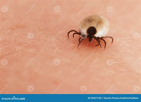 Tick On Human Skin Stock Photo Image Of Arachnid Dangerous 25057738