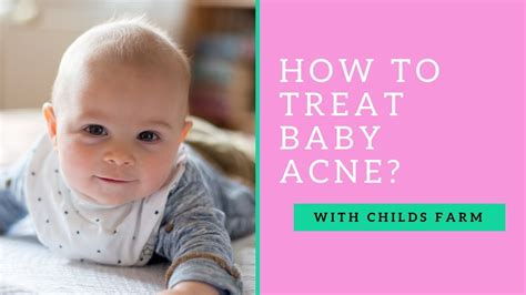 What Is Baby Acne And How Do You Treat It With Dr Jennifer Crawley And