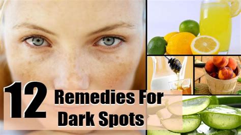 12 Effective Home Remedies For Dark Spots Remove Dark Spots Dark