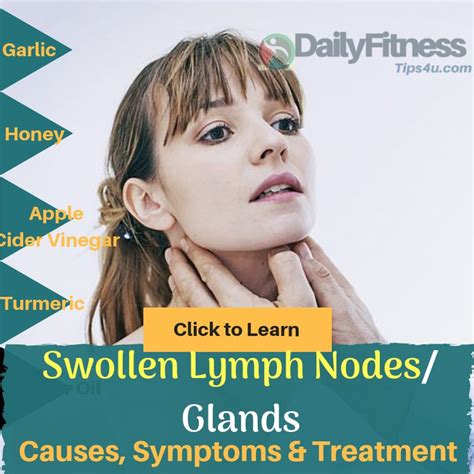 Swollen Lymph Nodes Causes Photos And Treatments Images And Photos