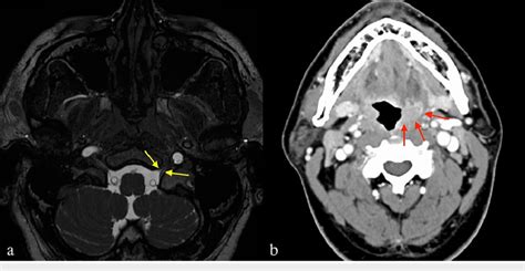 Mri And Contrast Enhanced Computed Tomography Cect Images At The