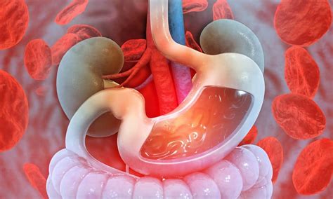 Cary Gastroenterology Associates Possible Causes Of