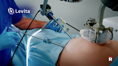 Levita Magnetics Announces World S First Commercial Use Of MARS Surgical System