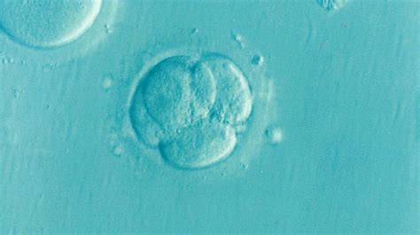 Assisted Reproduction Oi