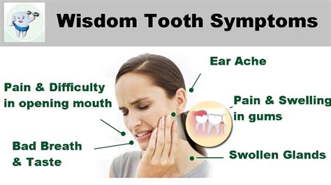 Wisdom Teeth Symptoms Youtube