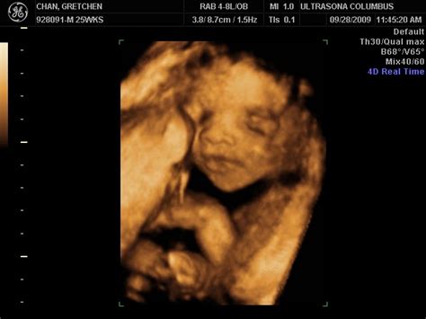 How much is a 3d ultrasound uk. Sweet Baby Chan: 3D Ultrasound 25 weeks!