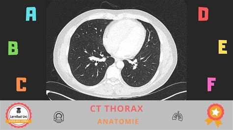 Anatomie In Der Computertomographie Ct Des Thorax Youtube