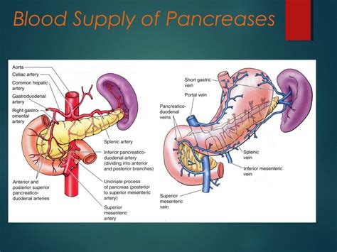 Pancreatico Pleural Fistula
