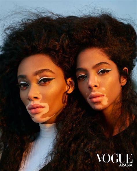 Winnie Harlow And Shahad Salman Met For The First Time On The Vogue
