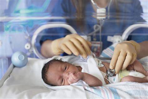 Yang Perlu Diperhatikan Saat Bayi Lahir Prematur Nawacita