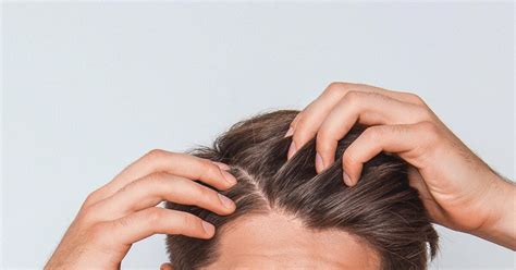 Scabs And Sores On Scalp Treatment Causes And Remedies