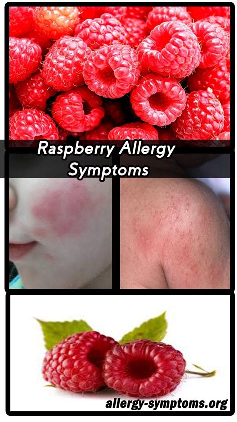 Raspberry Allergy Rash Pictures Raspberry