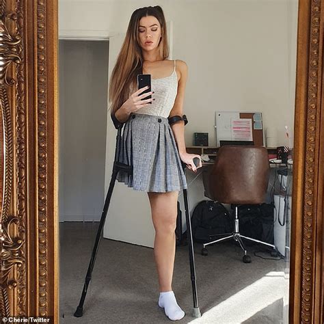 Amputee Posts Seemingly Innocent Tweet About Her One Leg Only To Be