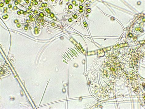Nostoc Under Microscope