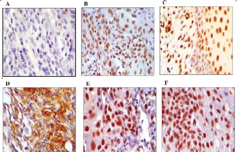 Representative images of IHC staining of A) Negative staining, B 