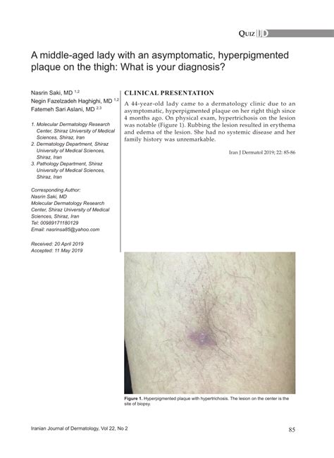 Pdf A Middle Aged Lady With An Asymptomatic Hyperpigmented Plaque On