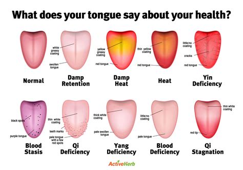 Tongue Diagram Activeherb Blog