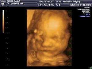 Meet The Bratzes 28 Weeks