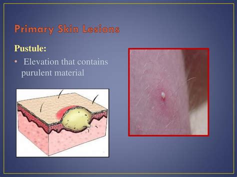 Ppt Introduction To Dermatology Powerpoint Presentation Free