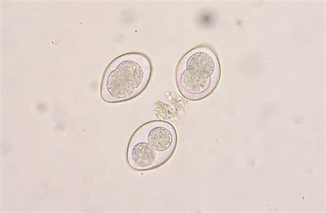 Coccidia is a bacteria that some cats/kittens carry in their intestines. 5 Gross Kitty Parasites You Should Know About - Catster