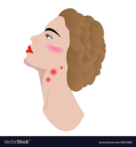 Swollen Lymph Nodes In Womans Neck Royalty Free Vector Image
