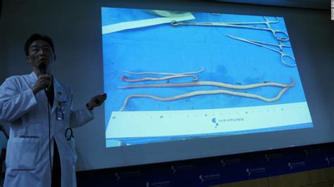 What Parasitic Worms In Defector Reveal About Health Conditions In