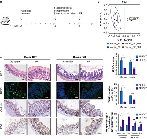 Preoperative Fasting Confers Protection Against Intestinal Ischaemia