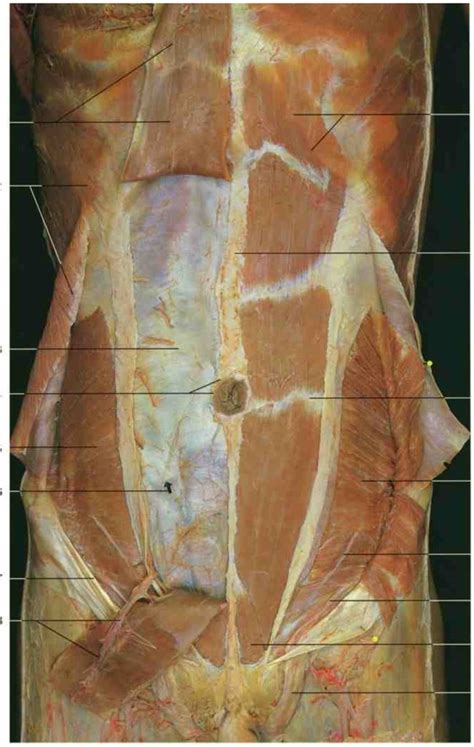 Anterior Abdominal Wall Cadaver Diagram Quizlet
