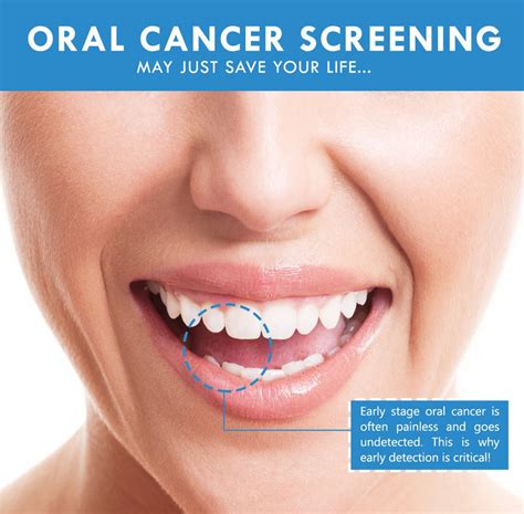 Oral Cancer Screening Leaside Laird Dental