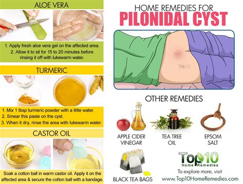 Home Remedies For Pilonidal Cysts Large Pimple At Bottom Of Tailbone Top 10 Home Remedies