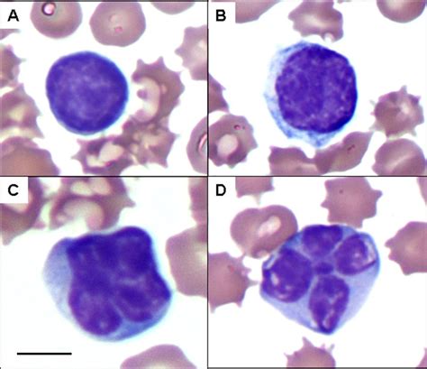 Reactive And Atypical Lymphocyte Morphologies Complete