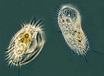 Protozoans: Characteristics, Types & Diseases Caused