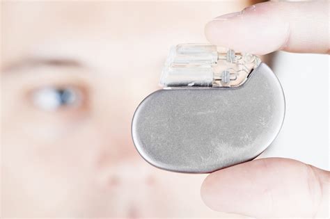 Value Of Emory Risk Score To Predict Permanent Pacemaker Implantation
