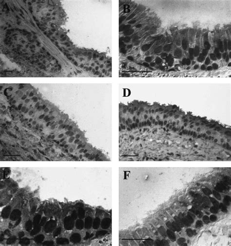 Morphology Of Human Airway Surface Epithelium Regenerated In Tracheal