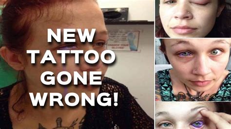 Ottawa Woman Gets Eyeball Tattoo May Lose Eye Beats And Speaks Youtube