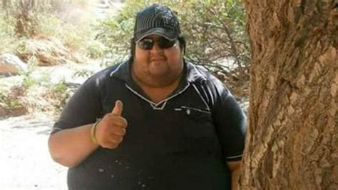 Murió Un Joven Con Obesidad Mórbida Pesaba 260 Kilos