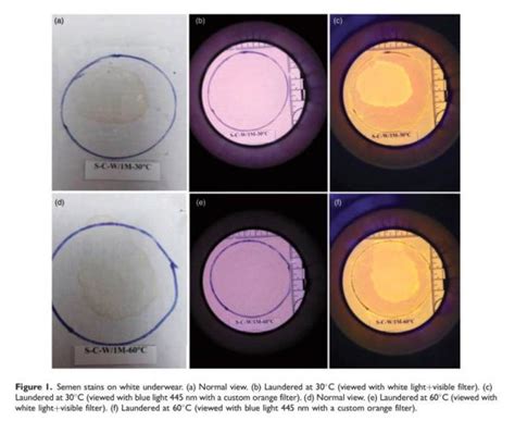 New Research On Evaluating Semen Stains Using Forensic Imaging