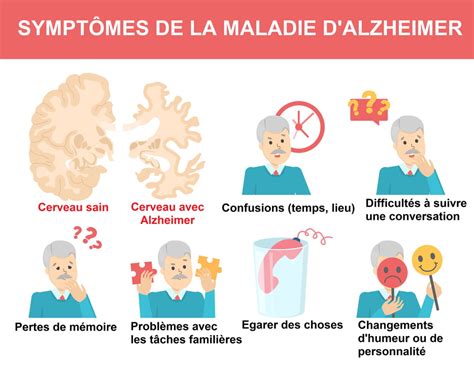 Les Signes De La Maladie Dalzheimer Au Début Et Après