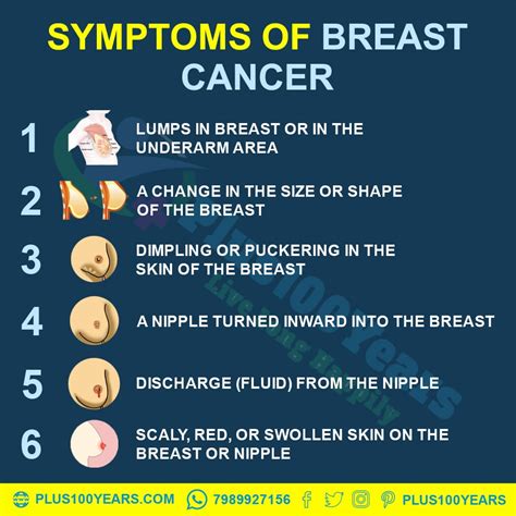 What Are The Causes Symptoms And Prevention Of Breast Cancer