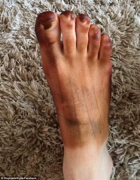 Men Share Pictures After Women Use Their Socks As Fake Tanning Mitts Daily Mail Online