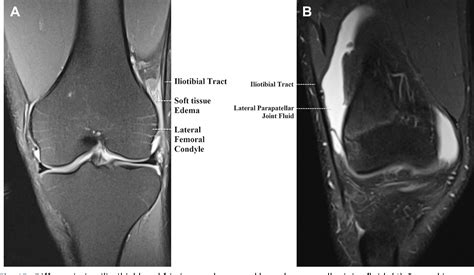 Figure 15 From Normal Mr Imaging Anatomy Of The Knee Semantic Scholar