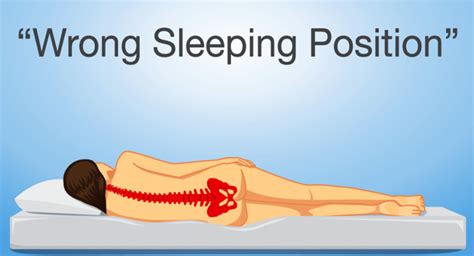 Best Sleeping Position For Sciatica Change Comin