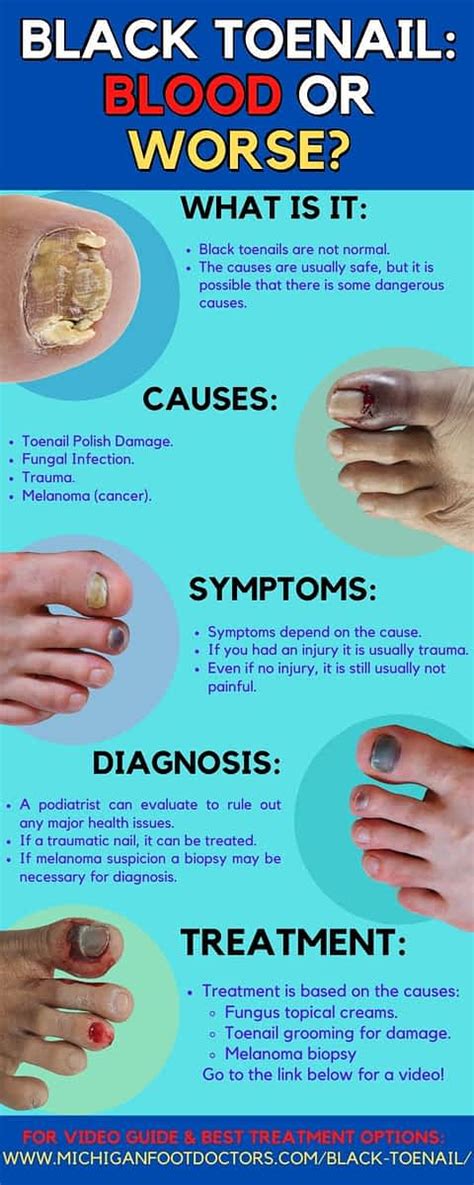 What Does Cancer Of The Foot Look Like Skin Cancer In The Feet