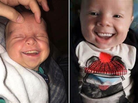 Chillingly Unusual Babies Sporting Adult Teeth Evoke An Unsettling