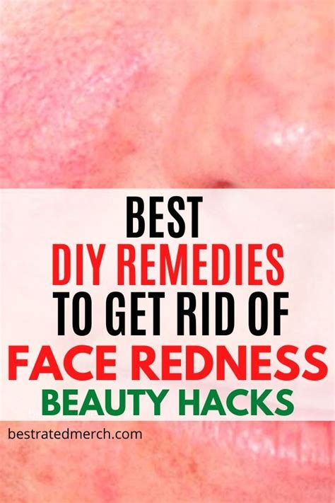Quickly Get Rid Of Face Redness With These Diy Home Treatments Red