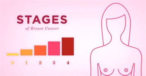 This List Breaks Down The Stages Of Breast Cancer And What They Mean The Breast Cancer Site News